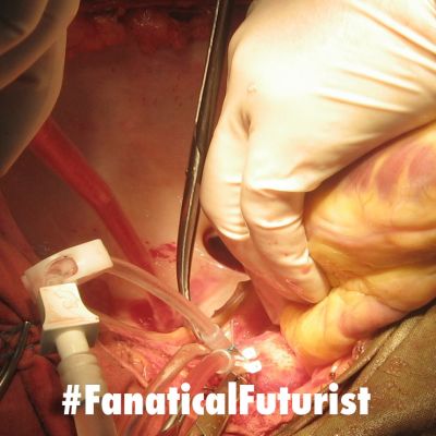 futurist_3d_in_vivo_printing